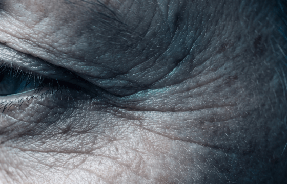 Ageing Skin