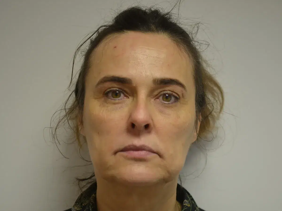 Midface volume, eight-point lift, before treatment at London Real Skin