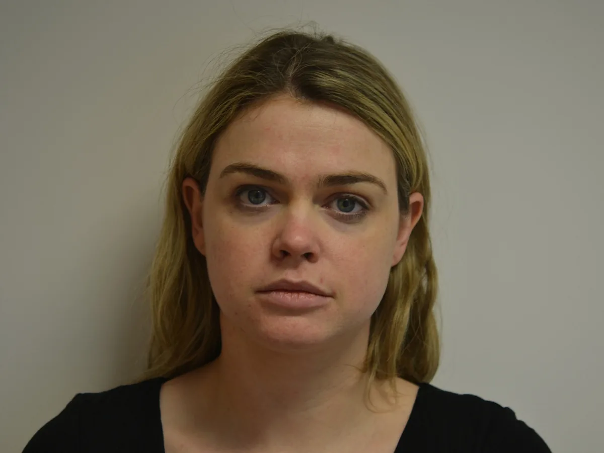 A narrower lower face, before treatment at London Real Skin